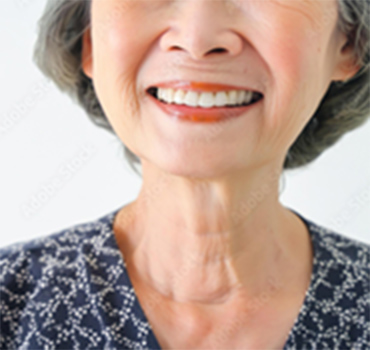 2.噛み合わせ・バランスの調整